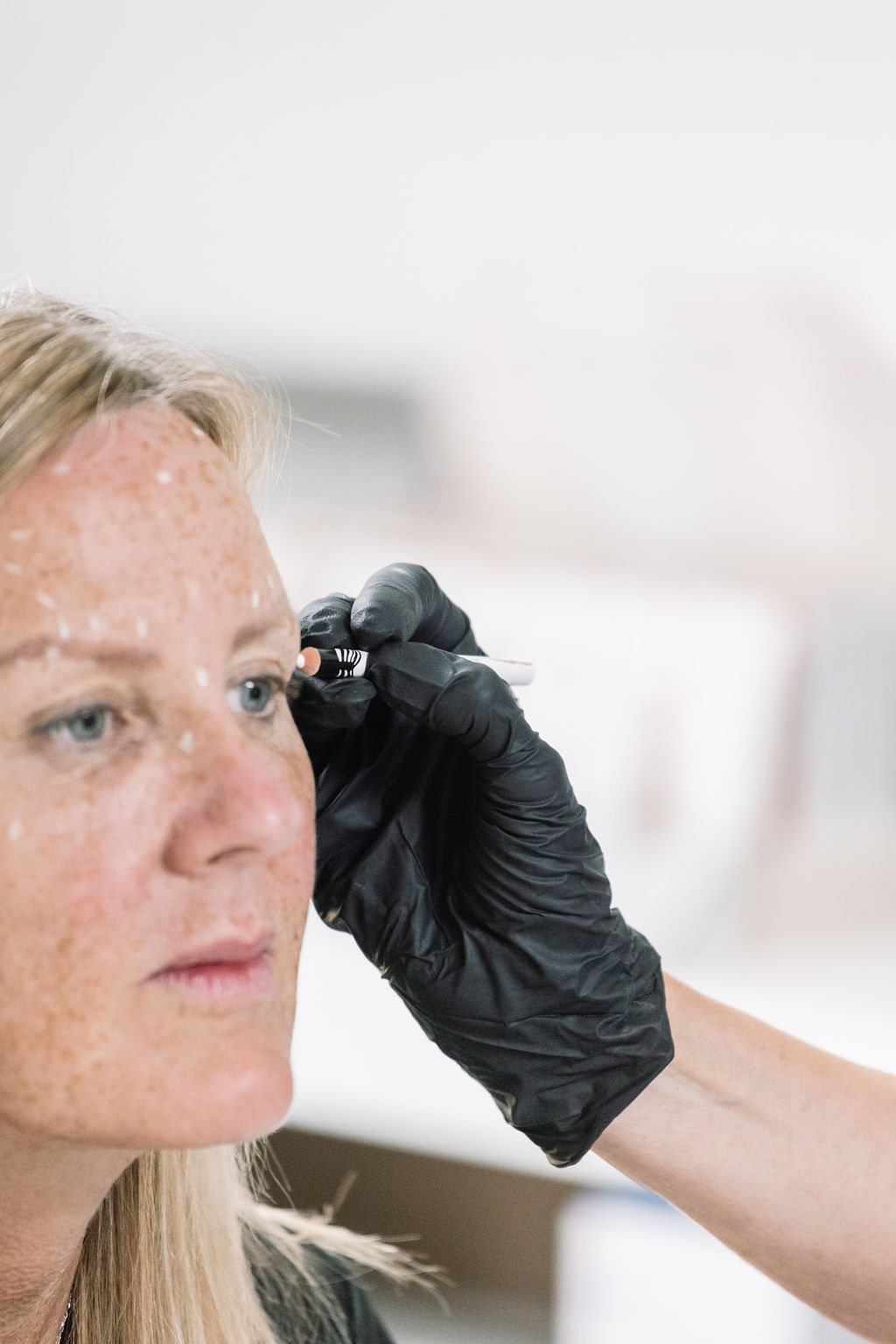 Skin mapping