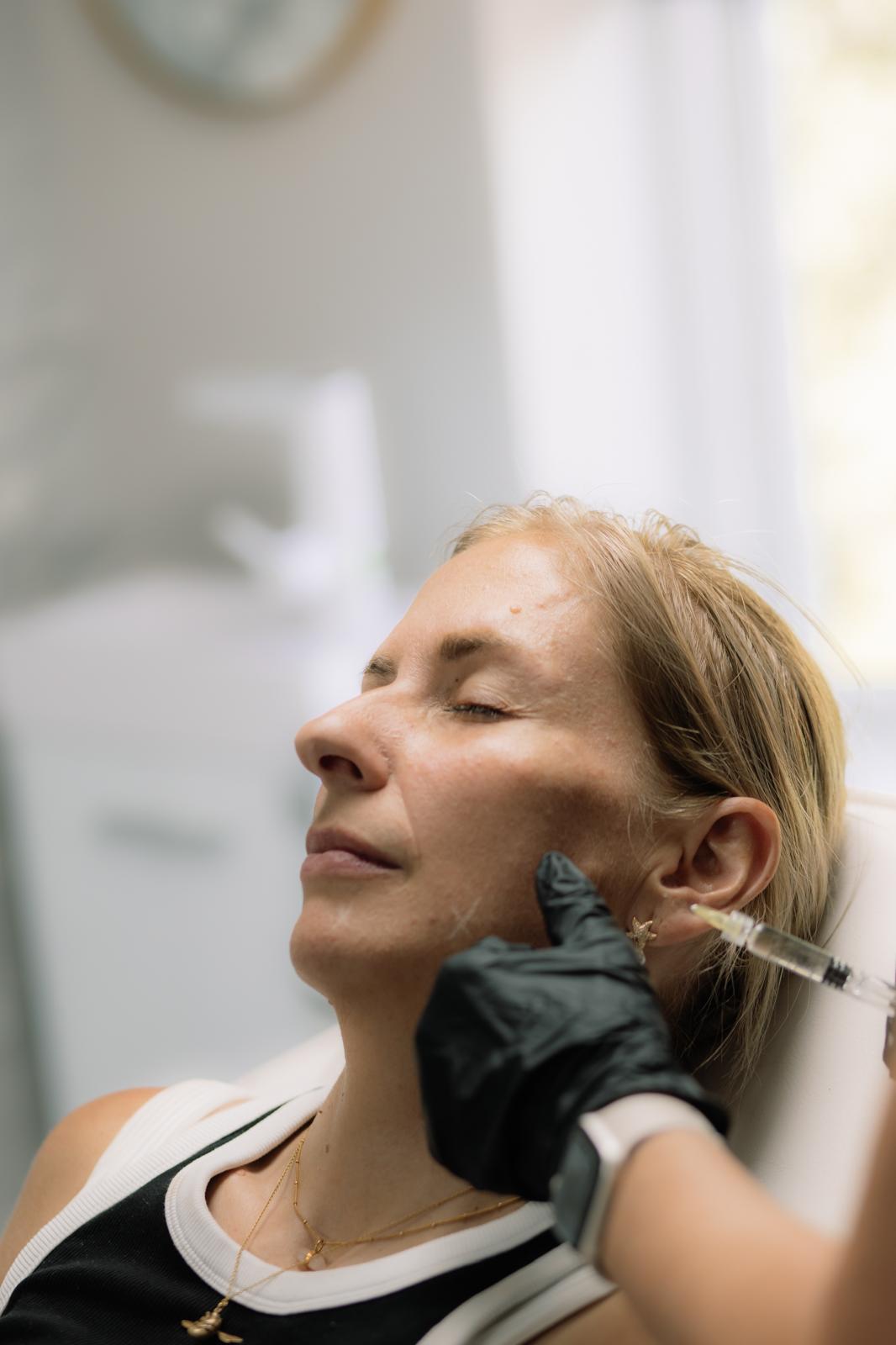 Profhilo treatment being administered at Gray's Aesthetics
